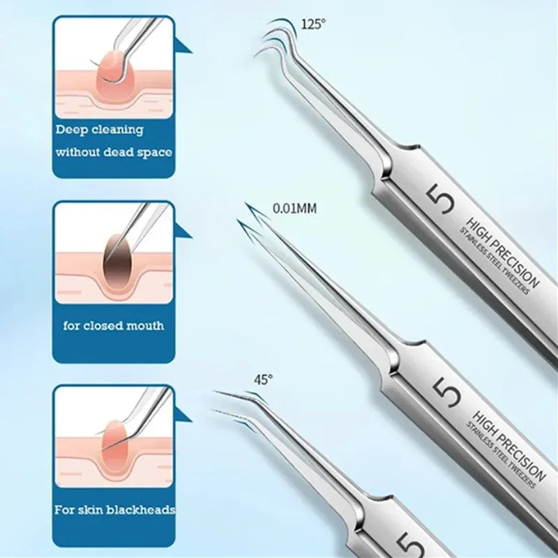 New Acne Blackhead Removal Kit Stainless Steel